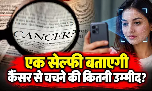 एक सेल्फी बताएगी कैंसर से बचने की कितनी उम्मीद? AI के नए प्रयोग ने जगाई उम्मीद