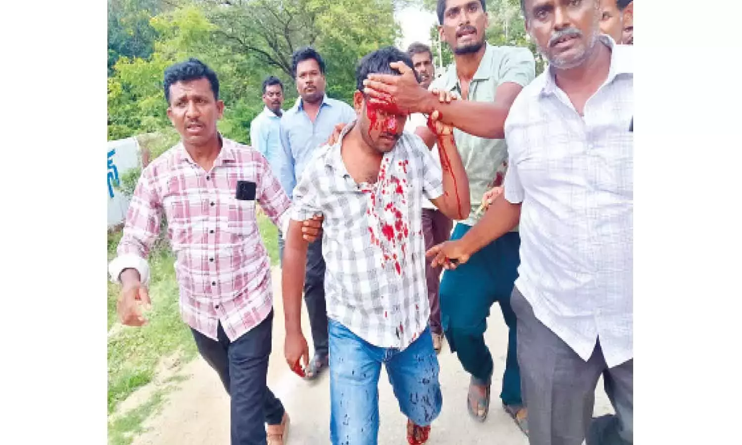 टीडीपी, YSRCP के बीच व्यापार आरोप-प्रत्यारोप से राजनीतिक तनाव बढ़ गया है टीडीपी, YSRCP के बीच व्यापार आरोप-प्रत्यारोप से राजनीतिक तनाव बढ़ गया है