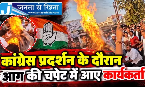 कांग्रेस प्रदर्शन के दौरान आग की चपेट में आए कार्यकर्ता