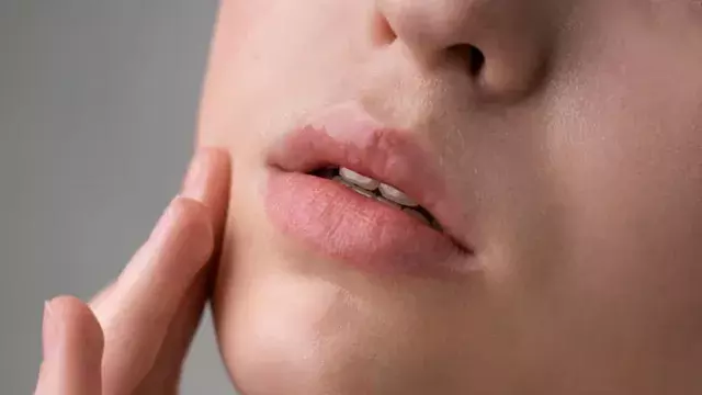 लिप बाम लगाने के बाद भी फट रहे होंठ? देखभाल में बदलें ये आदतें लिप बाम लगाने के बाद भी फट रहे होंठ? देखभाल में बदलें ये आदतें