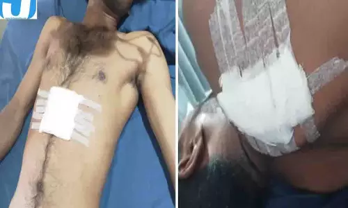रायपुर में चाकूबाजों का हमला, युवक को 7 बार मारा चाकू; एक की हालत नाजुक