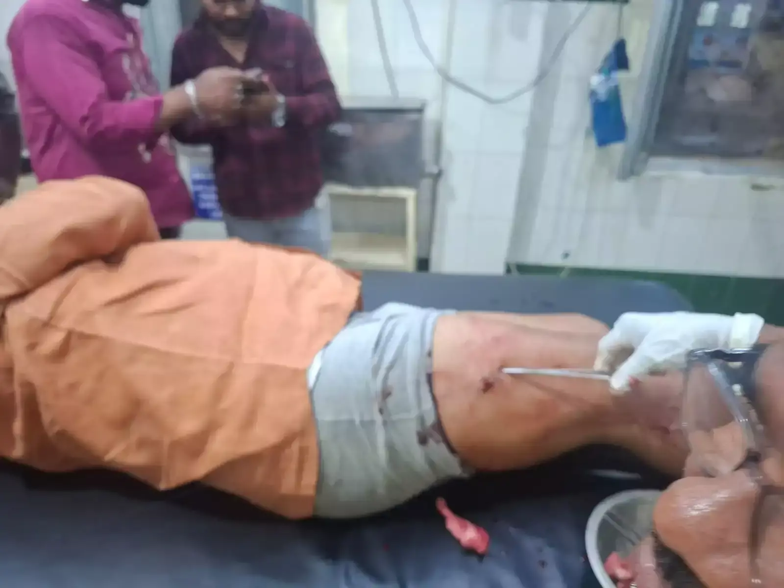 जबलपुर में पूर्व भाजपा मंडल अध्यक्ष पर चाकू से हमला, हालत गंभीर
