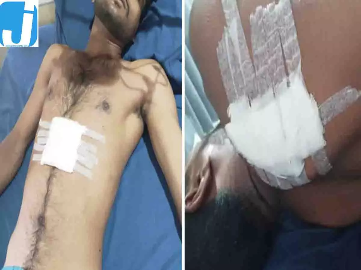रायपुर में चाकूबाजों का हमला, युवक को 7 बार मारा चाकू; एक की हालत नाजुक रायपुर में चाकूबाजों का हमला, युवक को 7 बार मारा चाकू; एक की हालत नाजुक