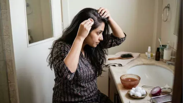 सर्दियों में डैंड्रफ से परेशान? प्याज लगाने से पहले जान लें फायदे और जोखिम सर्दियों में डैंड्रफ से परेशान? प्याज लगाने से पहले जान लें फायदे और जोखिम